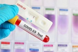 Hasil Rapid Test Anda Positif, Jangan Panik Dulu