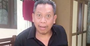 Kenali Gejala dan Penyebab Pendarahan Otak Seperti yang Dialami Tukul Arwana